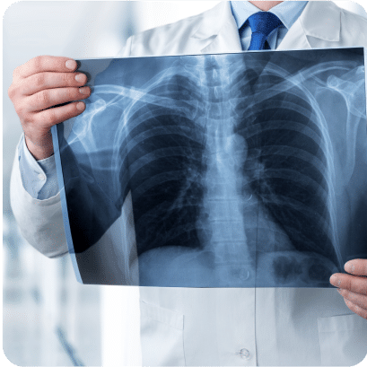 X - Ray Chest PA View